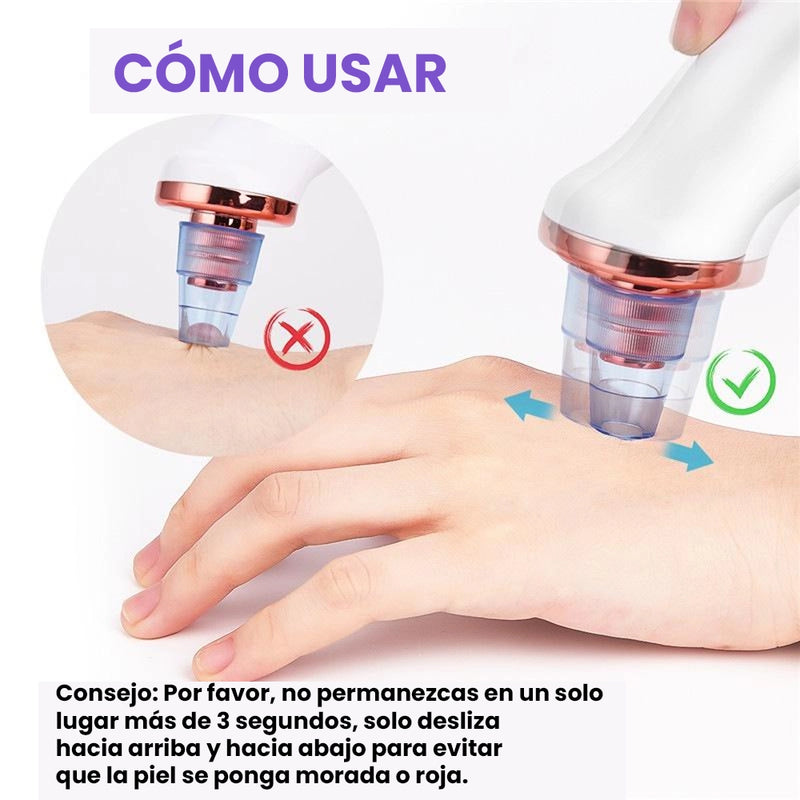 Removedor de Puntos Negros Por Succión Extraclean